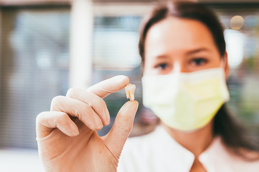 Dentist holdign extracted tooth